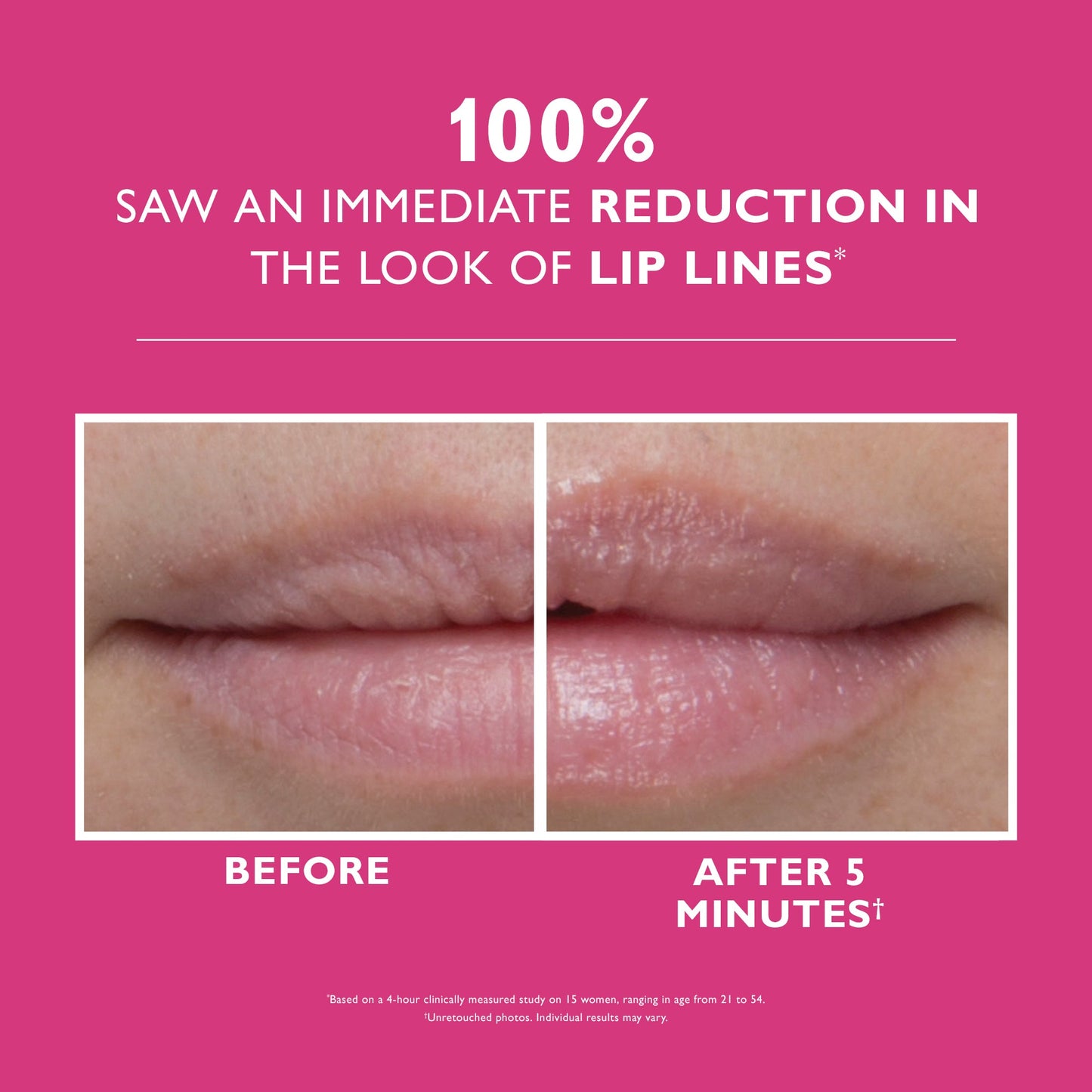 Instant FIRMx Lip Filler|10 ml / 0.3 fl oz